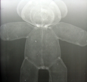 Roentgen Teddy